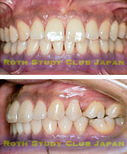 After orthodontic treatment